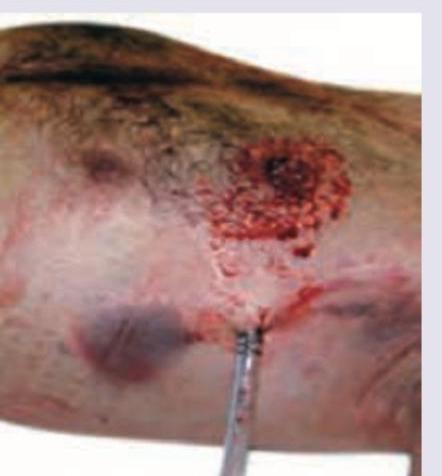 Image for question 743