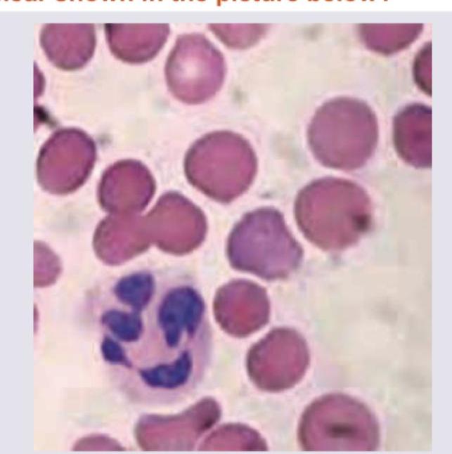 Image for question 864