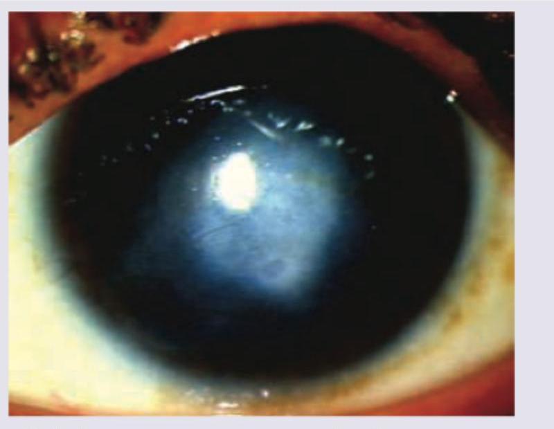 Image for question 326