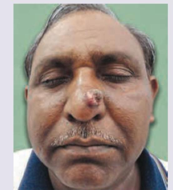 Image for question 212