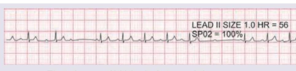 Image for question 61