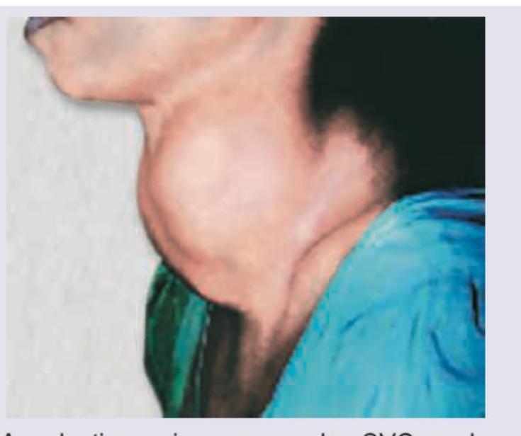 Image for question 226