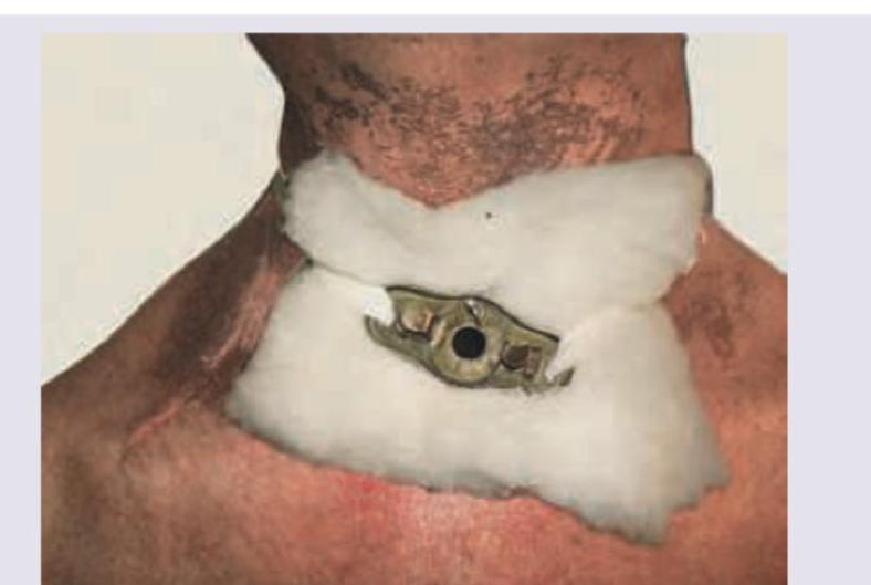 Image for question 760