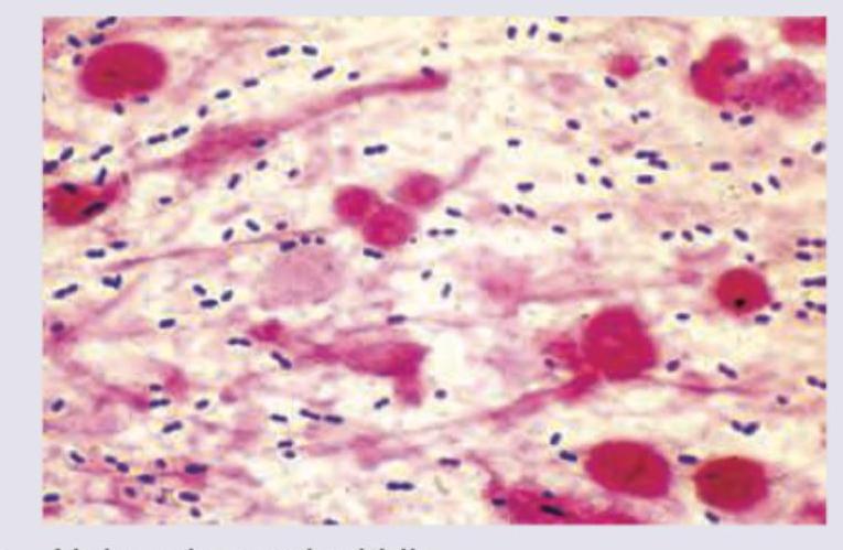 Image for question 122