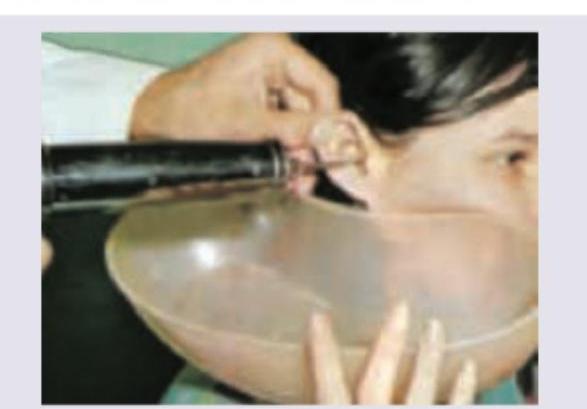 Image for question 187