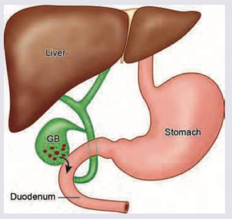 Image for question 702