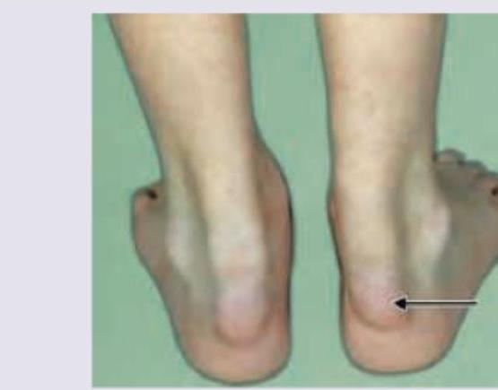 Image for question 206