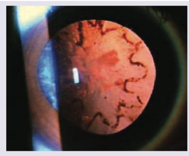 Image for question 245