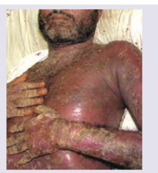 Image for question 167