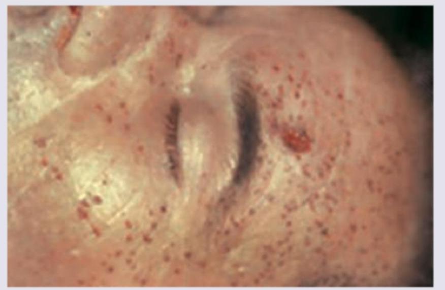 Image for question 10