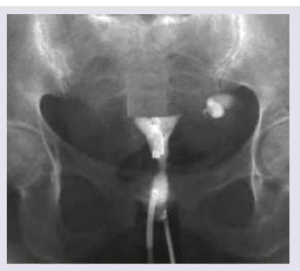 Image for question 905