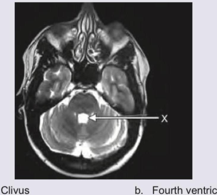 Image for question 361
