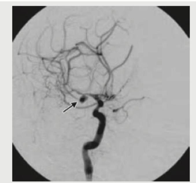 Image for question 1