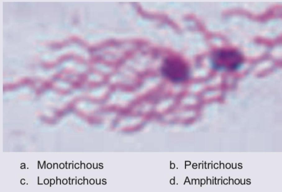 Image for question 177