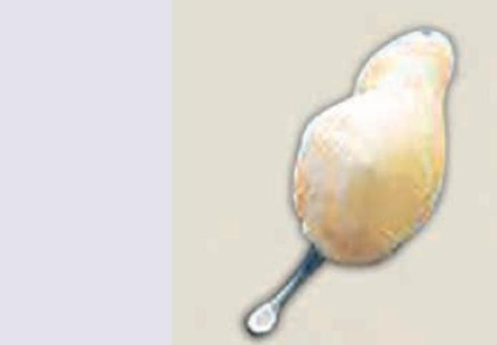 Image for question 111