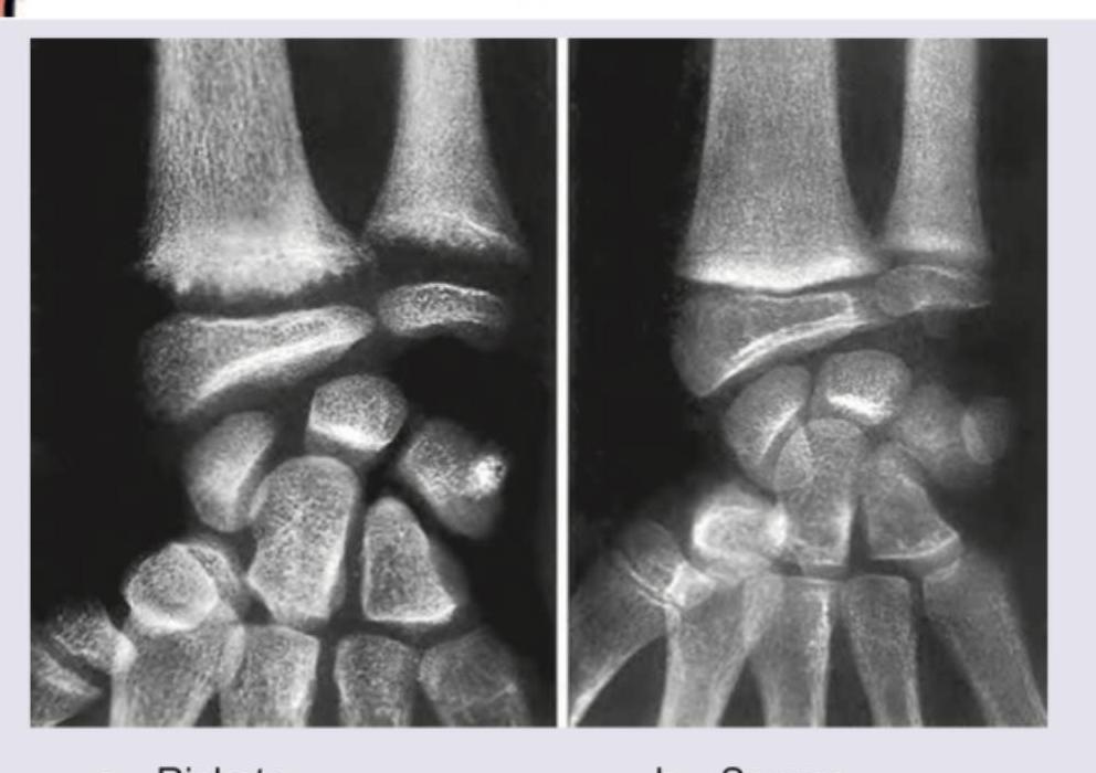 Image for question 364