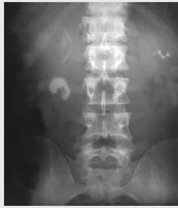 Image for question 179