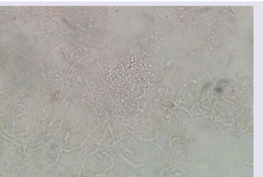 Image for question 119