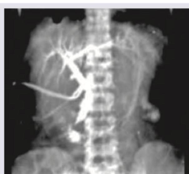 Image for question 495