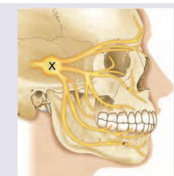 Image for question 7