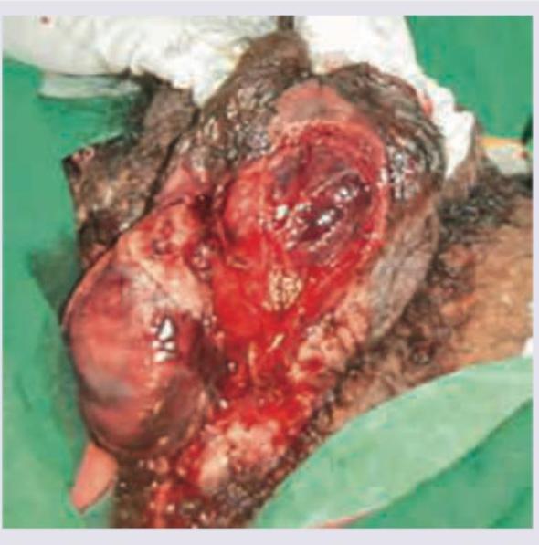 Image for question 99