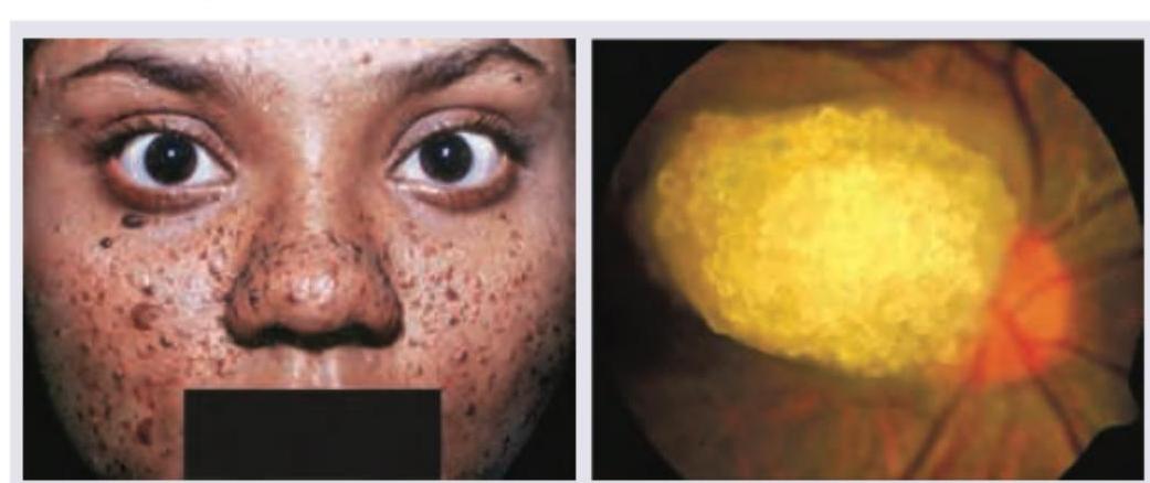 Image for question 400