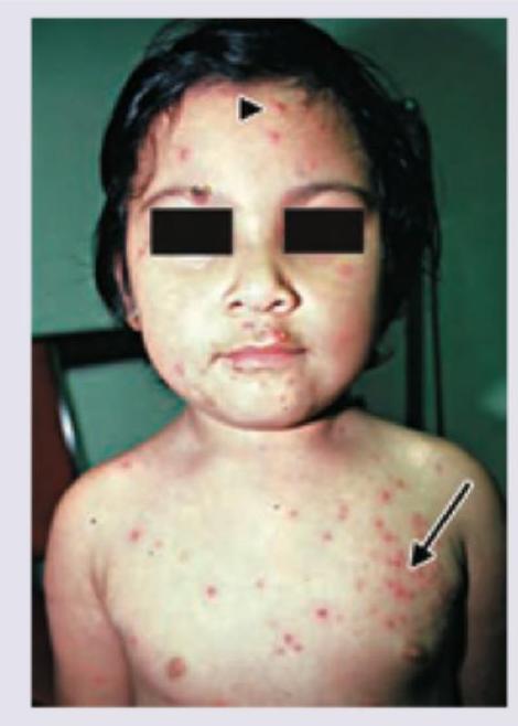 Image for question 356