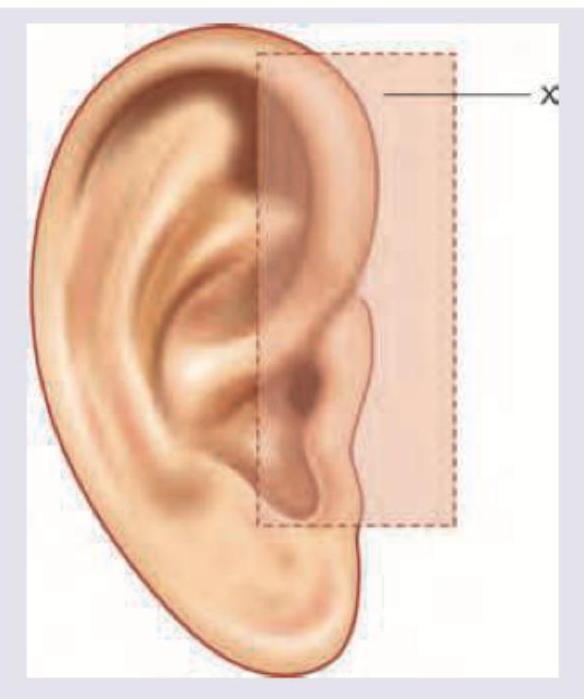 Image for question 1166