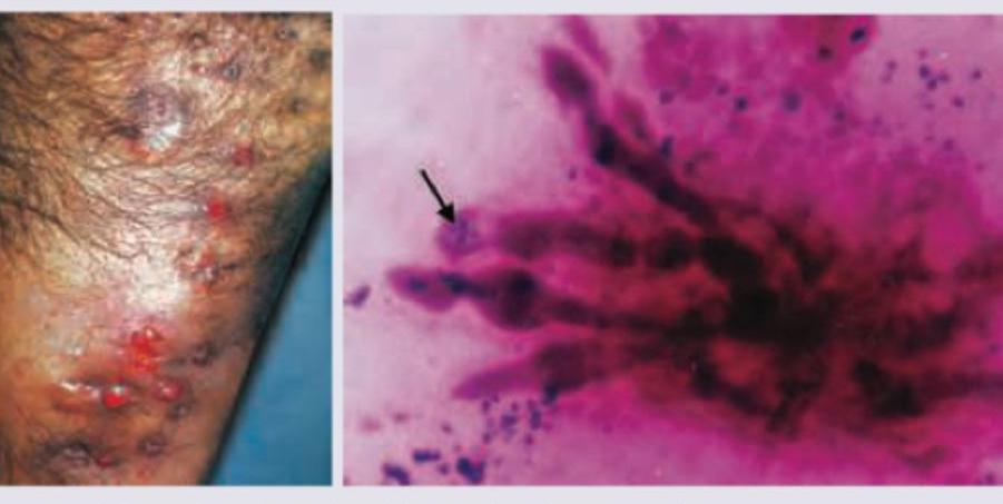 Image for question 51