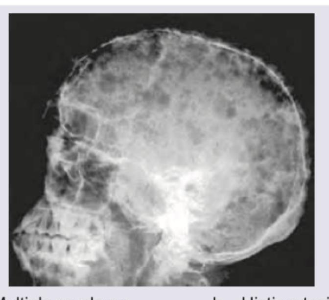 Image for question 130