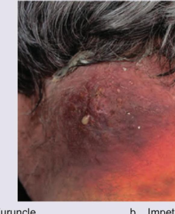 Image for question 162