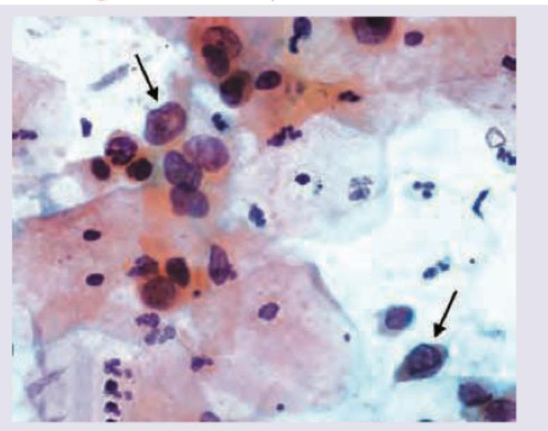 Image for question 921