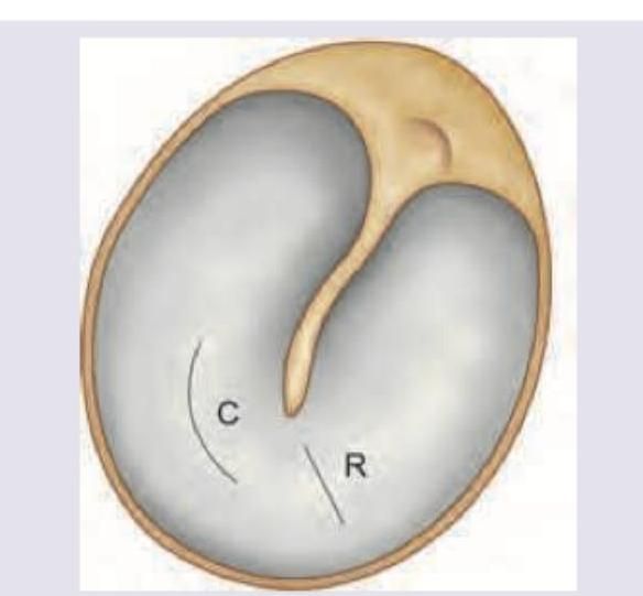 Image for question 287
