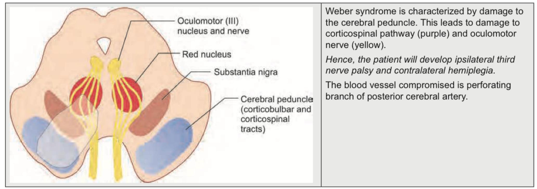 Image for question 39