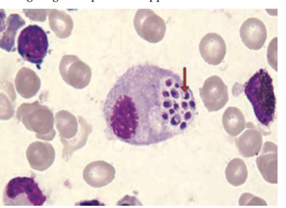 Image for question 455