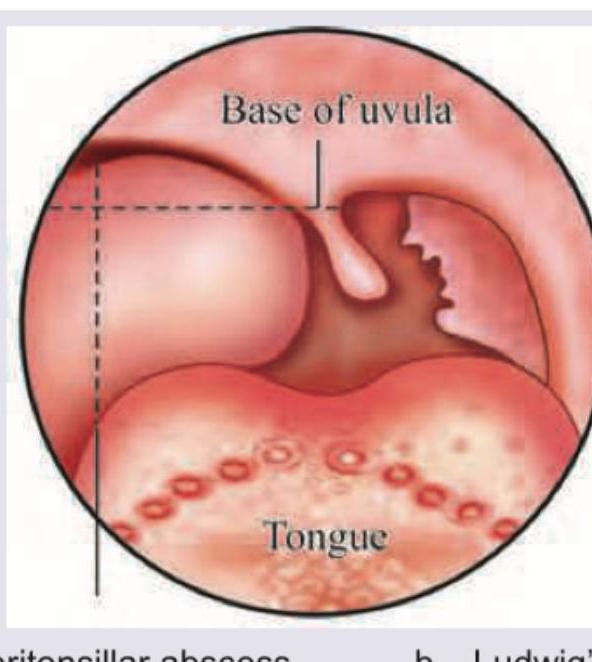 Image for question 257