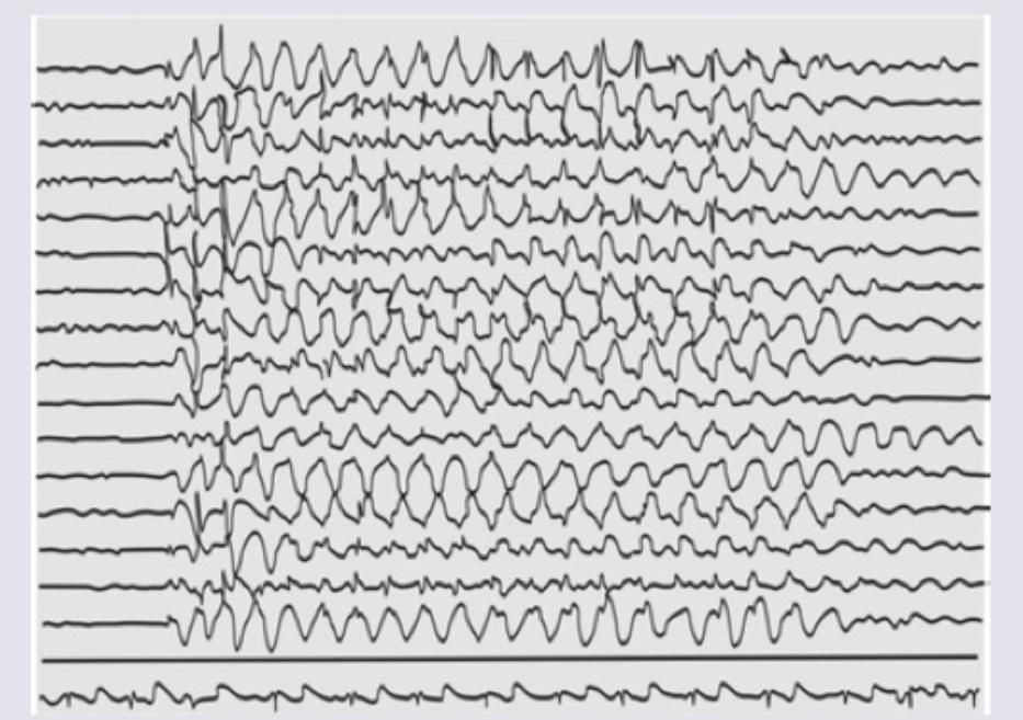 Image for question 1
