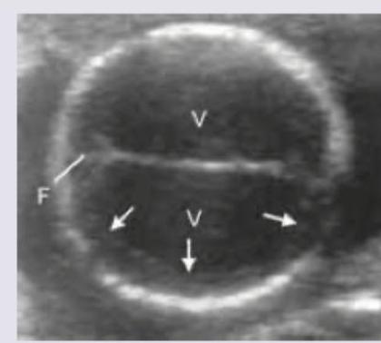 Image for question 932