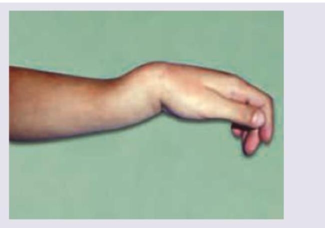 Image for question 915