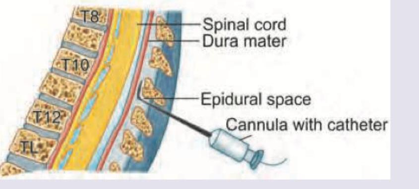 Image for question 130