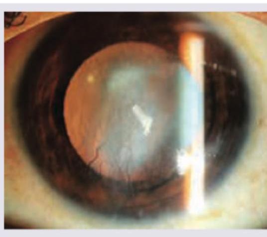 Image for question 316