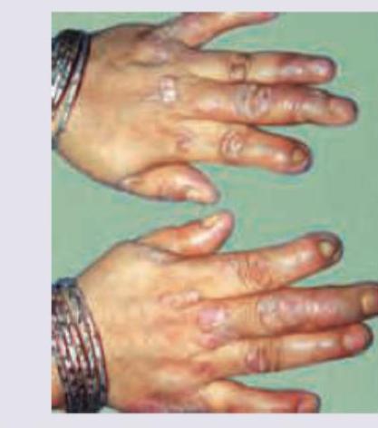 Image for question 86