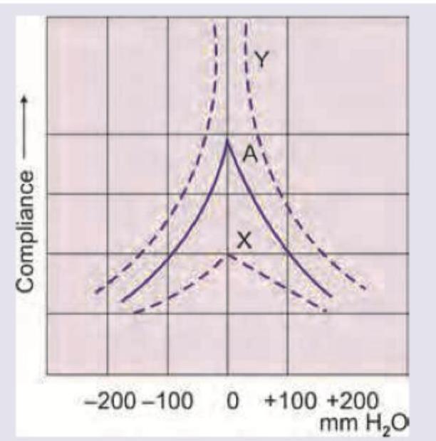 Image for question 205