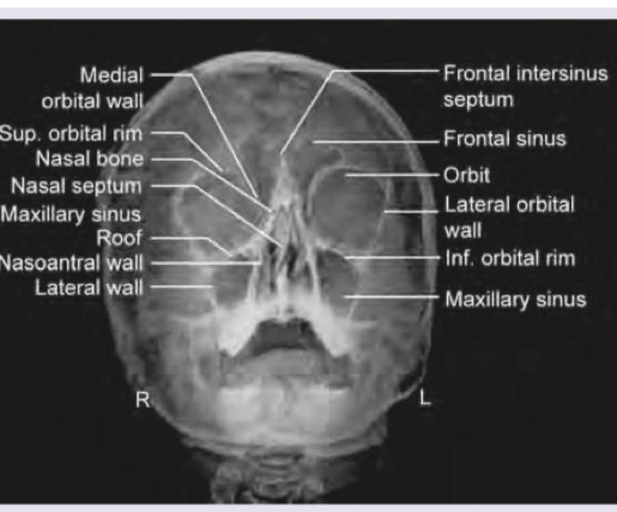 Image for question 125