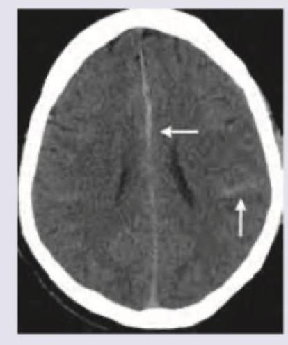 Image for question 704