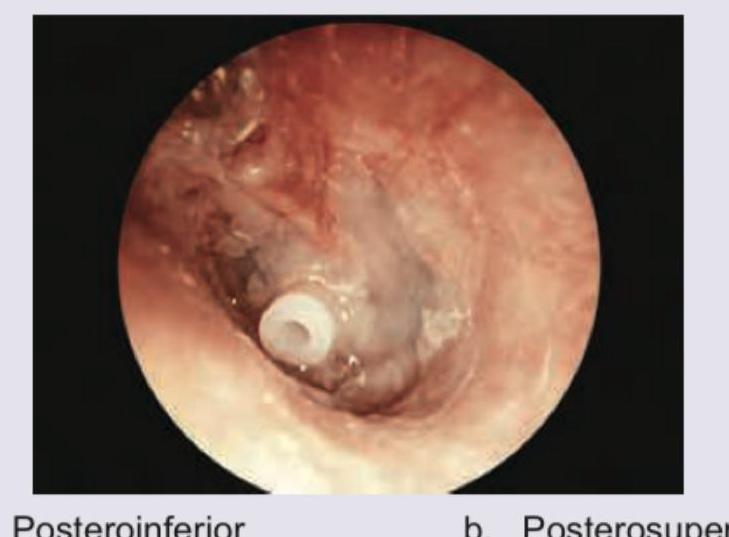 Image for question 192