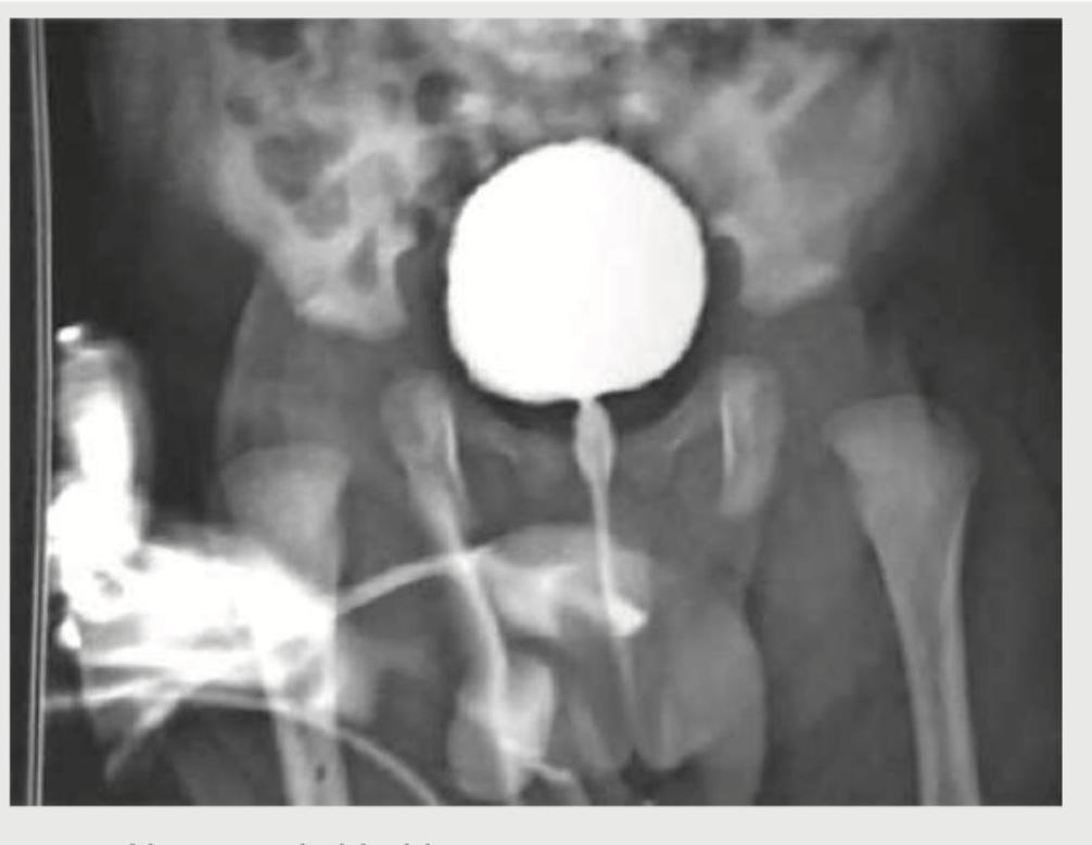 Image for question 187