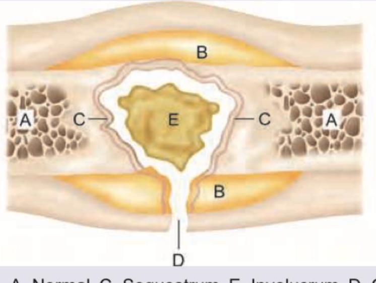 Image for question 193