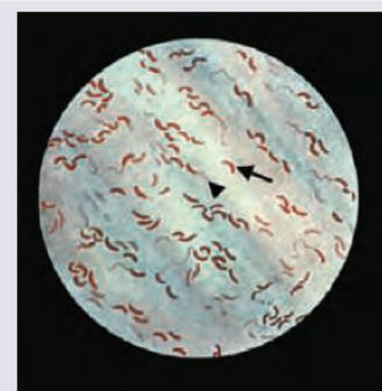 Image for question 120