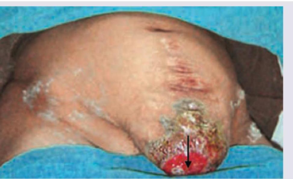 Image for question 775